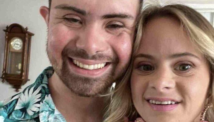 Couple with Down Syndrome attracted the web: she is an effective model and he is a successful businessman.
