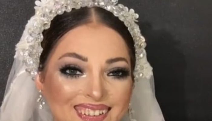 She was not perceived by the man of the hour! The lady went through an unbelievable change for her wedding.
