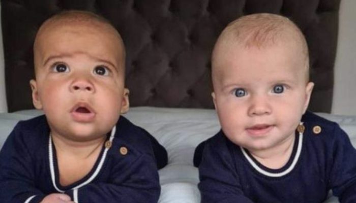 This couple had twins with white and black skin colors. The way they looked would attract everybody's heart.