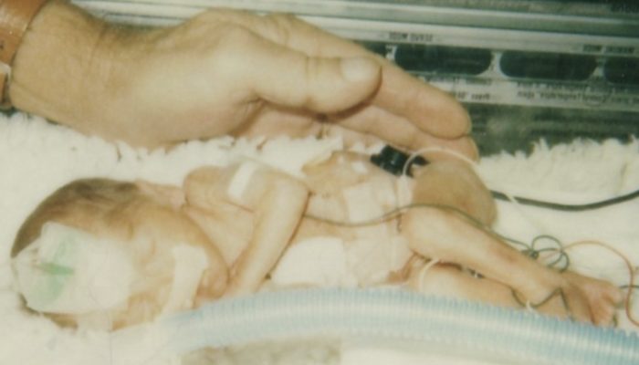 Only one-pound-wonder: the one who was littlest child in Texas currently works at the NICU that saved her life.