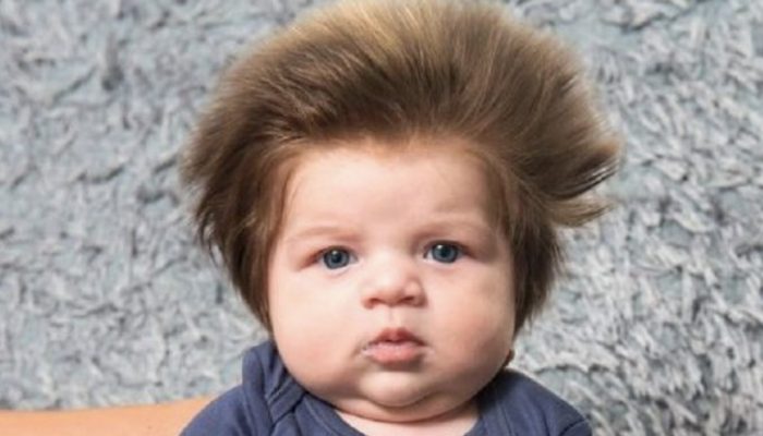What has happened with the young boy who attracted everybody's heart with his hair three years ago?