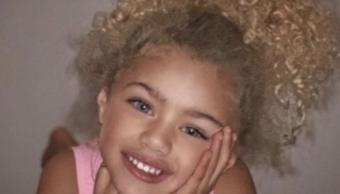 An interracial couple had a young lady of unearthly magnificence: You will be flabbergasted seeing what an angel resembles today.