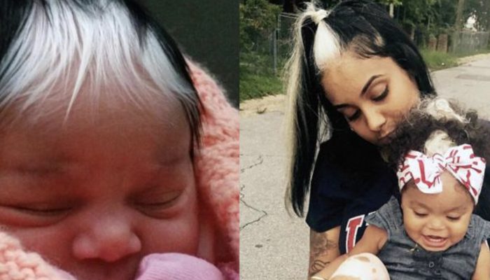 This little baby born with the same hair and with the same white hair as her mother. Everyone admired with them as they are like twins.