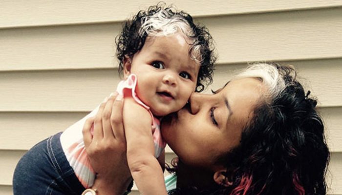 This little baby born with the same hair and with the same white hair as her mother. Everyone admired with them as they are like twins.