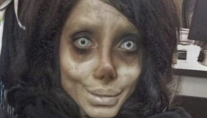 Iranian lady goes through 50 surgeries to seem to be Angelina Jolie and presently she seems to be a zombie.
