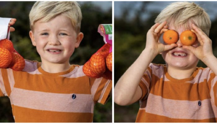 The child had consumed an excessive amount of orange, due to which the color of his face took on a strange hue. Seeing the oranges on his eyes will amaze you.