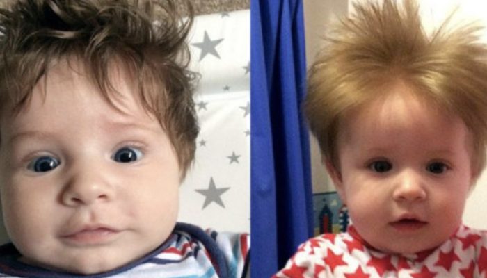After undergoing long treatments, the mother gave birth to two exceptional sons, which shocked the doctors.