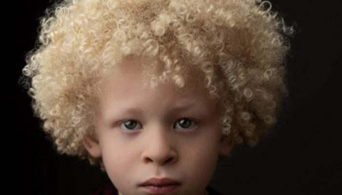 He began receiving modeling offers when his mother shared a picture of him on Facebook.