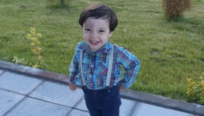 An infant with a birthmark on his forehead in the form of a heart. How does he look at age six?