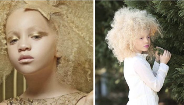 African albino girl has a unique appearance that makes it impossible to ignore how beautiful she is.
