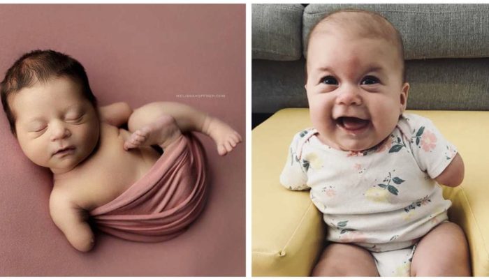 The lovely baby was born without arms. She is able to play the cello and have a complete life. How she looks like now, will amaze you.