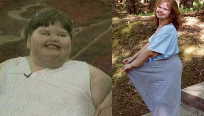 The girl weighed 220 kg at the age of 7, look how she looks now.