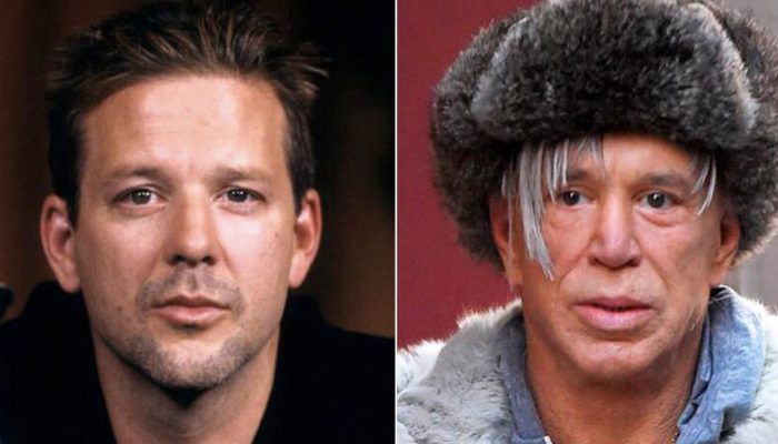 Nine stars that are almost impossible to recognize after plastic surgery. They are bright examples when the doctor went too beyond.