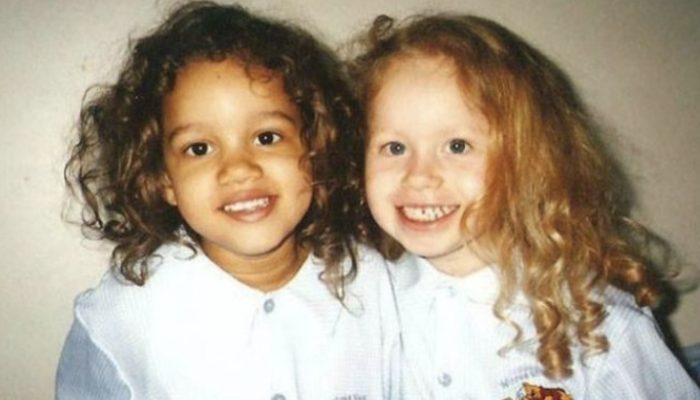 These lovely identical twins were born with distinctly different skin tones. Now they are both 27 years old.