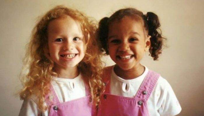 These lovely identical twins were born with distinctly different skin tones. Now they are both 27 years old.