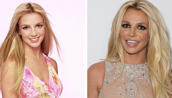 Nine stars that are almost impossible to recognize after plastic surgery. They are bright examples when the doctor went too beyond.