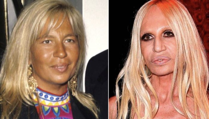 Nine stars that are almost impossible to recognize after plastic surgery. They are bright examples when the doctor went too beyond.