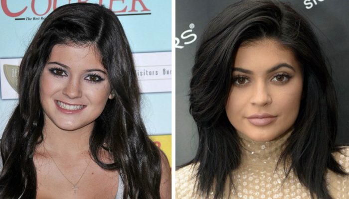 Nine stars that are almost impossible to recognize after plastic surgery. They are bright examples when the doctor went too beyond.