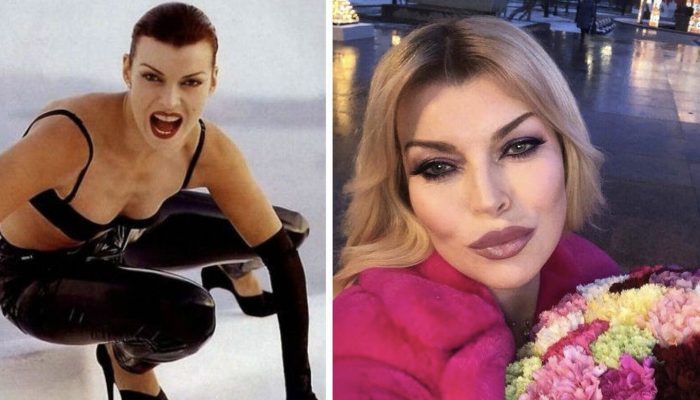 Nine stars that are almost impossible to recognize after plastic surgery. They are bright examples when the doctor went too beyond.