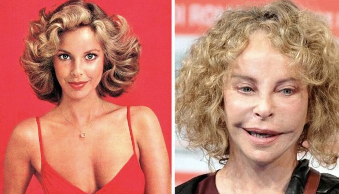 Nine stars that are almost impossible to recognize after plastic surgery. They are bright examples when the doctor went too beyond.