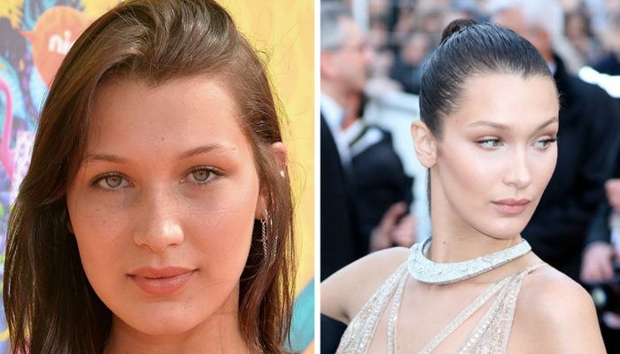 Nine stars that are almost impossible to recognize after plastic surgery. They are bright examples when the doctor went too beyond.