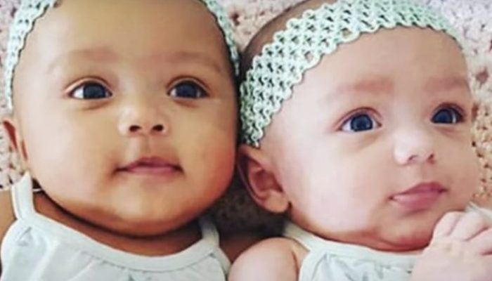 A woman gave birth to identical twins with distinct skin tones, but after seven years, she received another surprise.