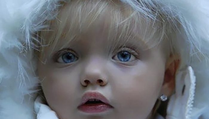 What is the current appearance of the girl who was thought to be a doll when she was younger?