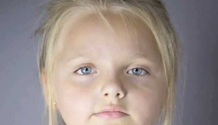 What is the current appearance of the girl who was thought to be a doll when she was younger?