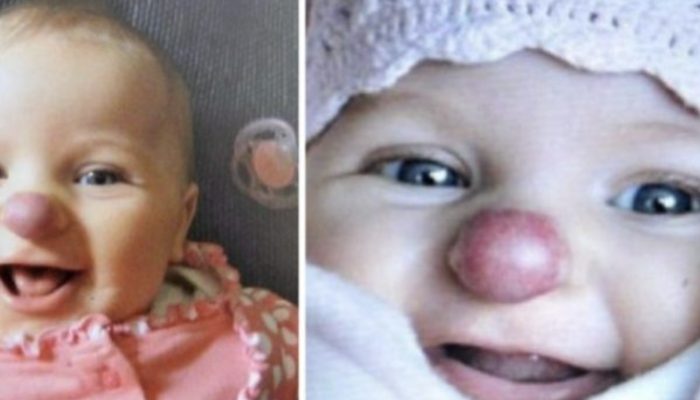 This red-nosed beauty was present at birth in this unusual condition. Look at her appearance now.