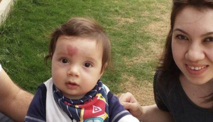 A baby with a heart-shaped birthmark was born in 2015. And, this is how he looks now, four years later.