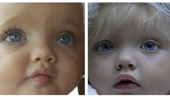 What is the current appearance of the girl who was thought to be a doll when she was younger?