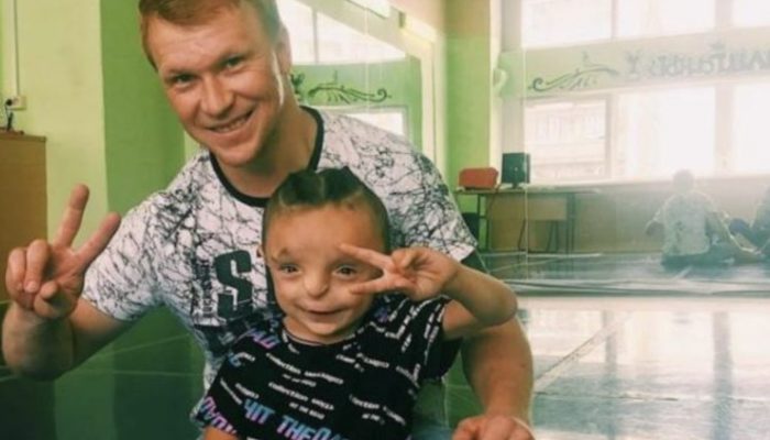 Check out the boy's current appearance after a kind mother adopted him when no one else would.