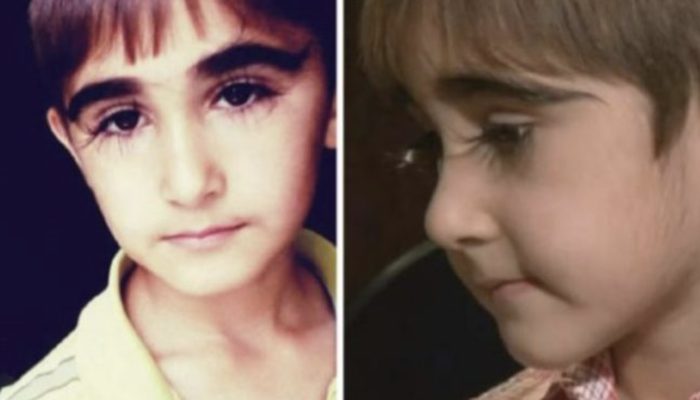Everyone was drawn to this 13-year-old girl's unusual appearance. She has lengthy eyelashes.