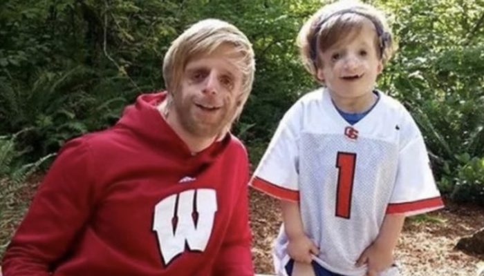 After this young boy was born, his parents left him. Here is what he looks like now.