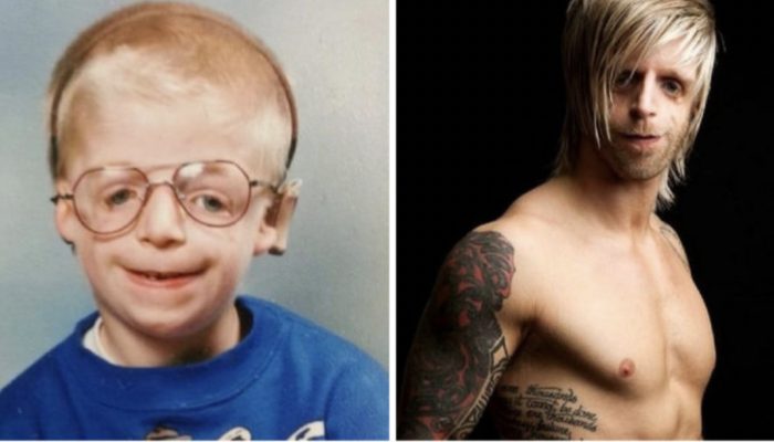 After this young boy was born, his parents left him. Here is what he looks like now.