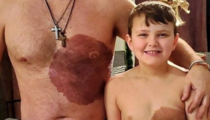 Dad spends 30 hours on a tattoo to match his son's distinctive birthmark and boost his confidence.