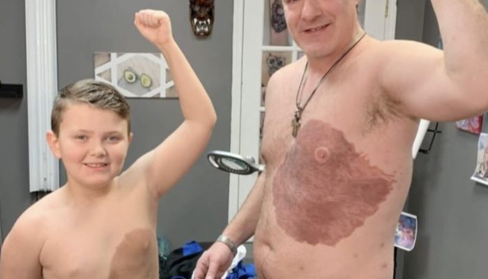 Dad spends 30 hours on a tattoo to match his son's distinctive birthmark and boost his confidence.