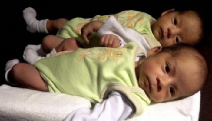The adorable little child saved his twin brother's life. Their story astounded everyone.