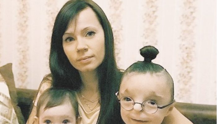 Check out the boy's current appearance after a kind mother adopted him when no one else would.