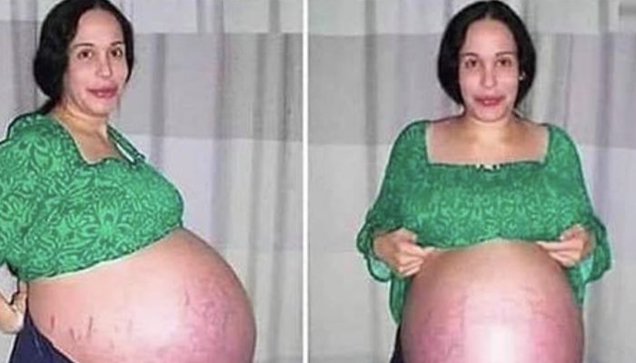 The woman gave birth to 8 lovely children. Take a look at these children now.