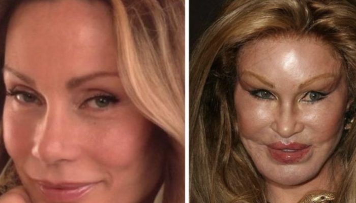 The Catwoman of our time. What a woman with a unique appearance looked like before plastic surgery.