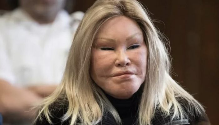 The Catwoman of our time. What a woman with a unique appearance looked like before plastic surgery.