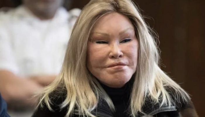 The Catwoman of our time. What a woman with a unique appearance looked like before plastic surgery.
