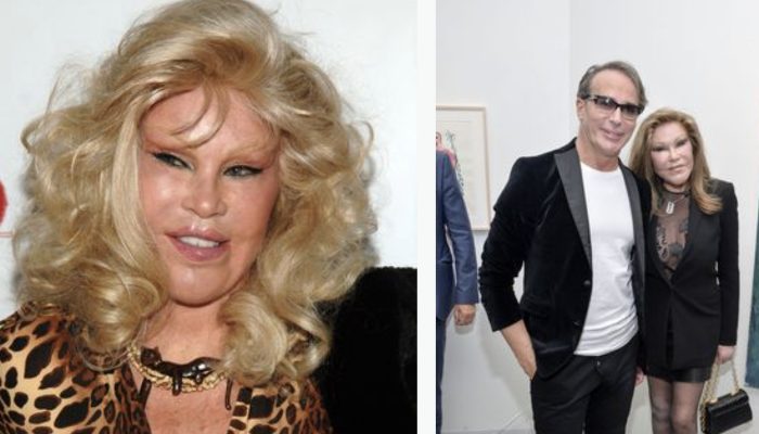 The Catwoman of our time. What a woman with a unique appearance looked like before plastic surgery.