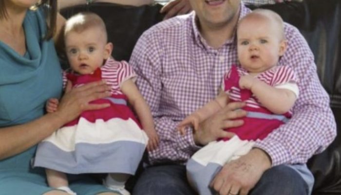 These extraordinary twins are recognized in the Guinness Book of Records. Their story is simply incredible.