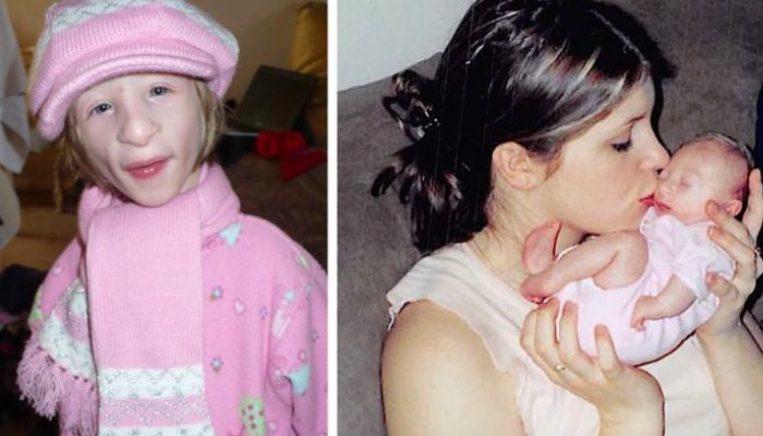 Even though a 19-year-old girl weighs barely 11 kg, she leads a lovely life.