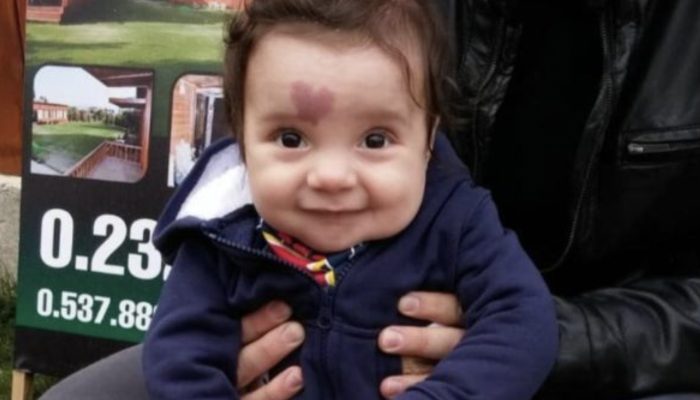 A baby with a heart-shaped mole captivated the entire world: see how he looks now.