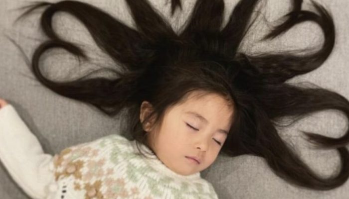 Due to her stunning hairstyle, the infant baby became well-known. Look at how she looks three years later.