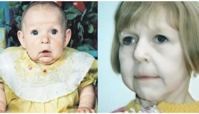 A 27-year-old woman is often confused for an elderly woman. Look at her children.