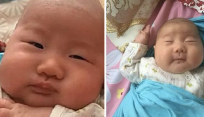 Meet the little beauty that surprised everyone with her appearance as a newborn baby girl.